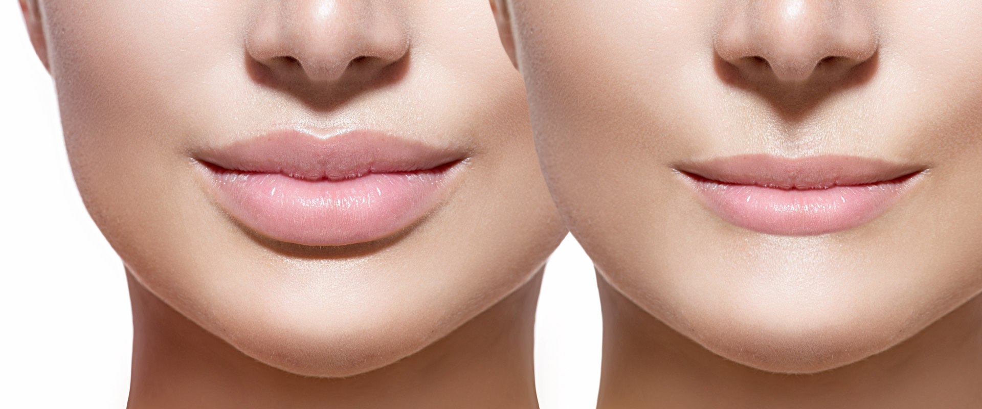 What are the Permanent Lip Injections Options?